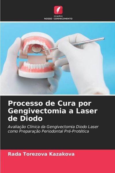 Cover for Rada Torezova Kazakova · Processo de Cura por Gengivectomia a Laser de Diodo (Pocketbok) (2021)