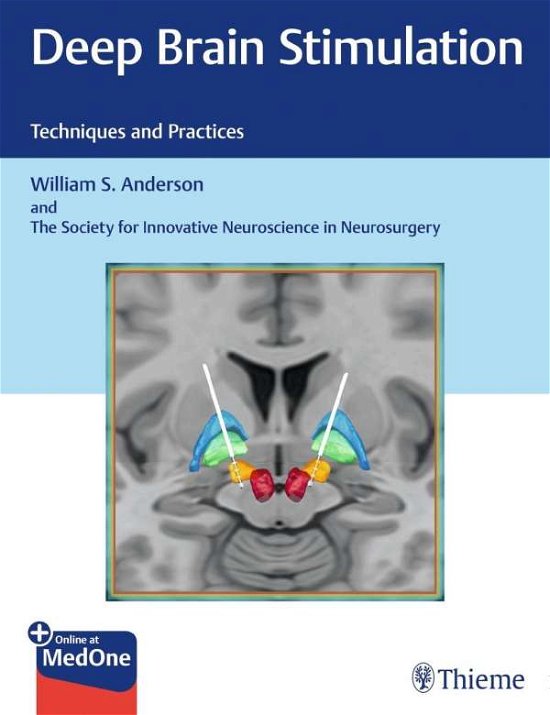 Deep Brain Stimulation: Techniques and Practices - William S. Anderson - Kirjat - Thieme Medical Publishers Inc - 9781626237971 - maanantai 6. toukokuuta 2019
