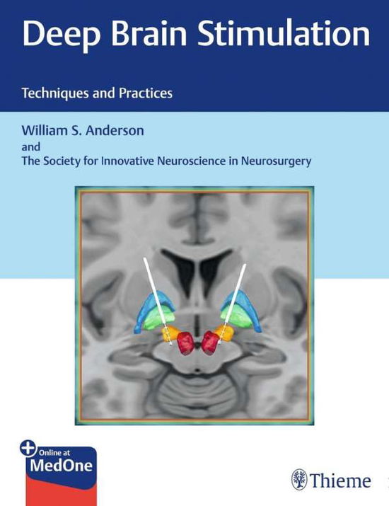 Cover for William S. Anderson · Deep Brain Stimulation: Techniques and Practices (Hardcover bog) (2019)