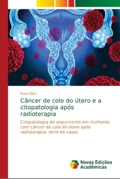 Cover for Ruan Silva · Cancer de colo do utero e a citopatologia apos radioterapia (Pocketbok) (2018)