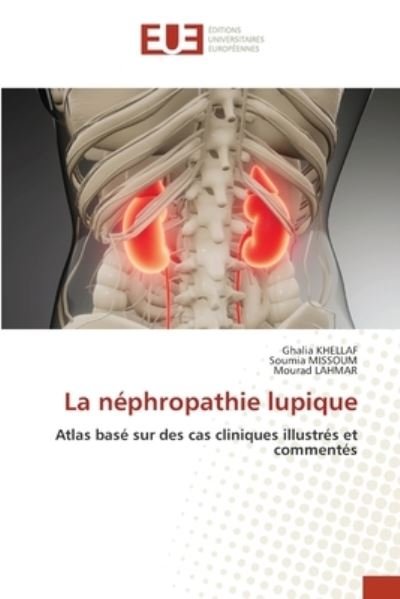 Cover for Ghalia Khellaf · La nephropathie lupique (Paperback Book) (2021)