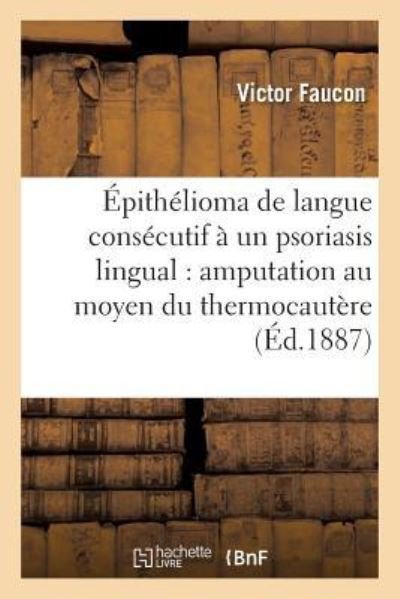 Cover for Faucon-v · Épithélioma de la langue consécutif à un psoriasis lingual (Paperback Bog) (2017)