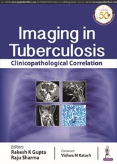 Cover for Rakesh K Gupta · Imaging in Tuberculosis: Clinicopathological Correlation (Paperback Book) (2019)