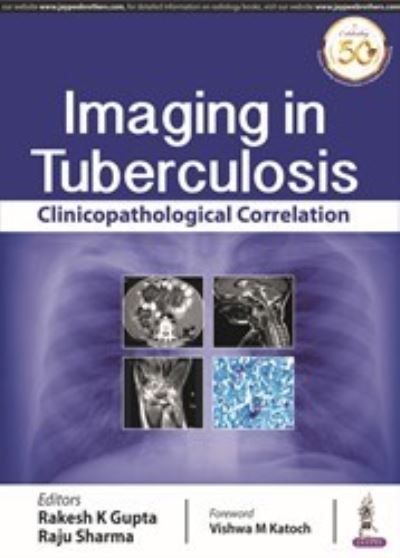 Imaging in Tuberculosis: Clinicopathological Correlation - Rakesh K Gupta - Books - Jaypee Brothers Medical Publishers - 9789388958974 - October 31, 2019