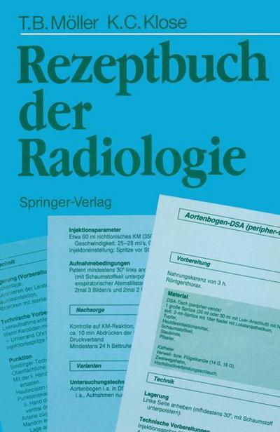 Cover for Torsten Bert Moller · Rezeptbuch der Radiologie (Taschenbuch) [German edition] (1989)