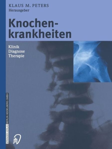 Cover for Klaus M Peters · Knochenkrankheiten: Klinik Diagnose Therapie (Paperback Book) [Softcover reprint of the original 1st ed. 2002 edition] (2012)