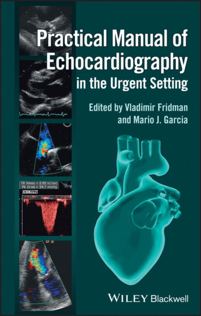 Cover for Practical Manual of Echocardiography in the Urgent Setting (Paperback Book) (2013)