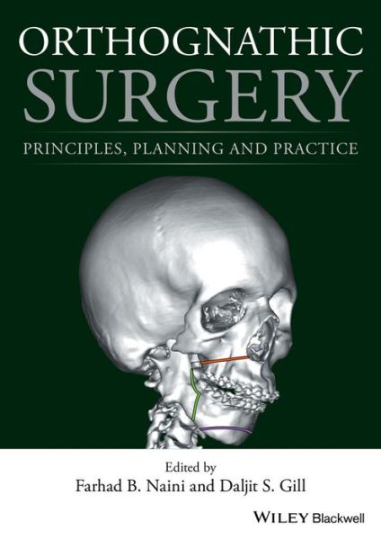 Cover for F Naini · Orthognathic Surgery: Principles, Planning and Practice (Hardcover Book) (2017)