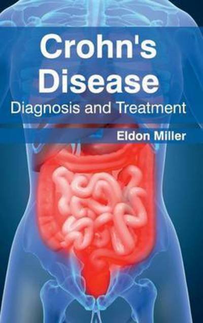 Cover for Eldon Miller · Crohn's Disease: Diagnosis and Treatment (Gebundenes Buch) (2015)