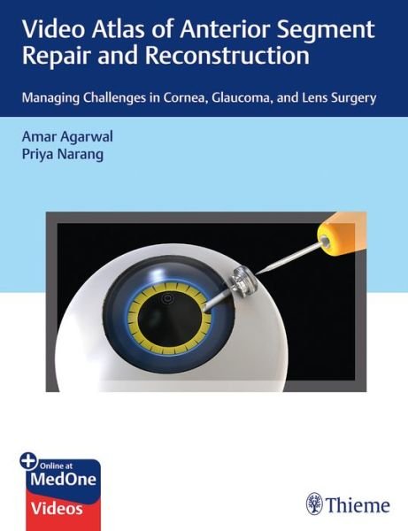 Video Atlas of Anterior Segment Repair and Reconstruction: Managing Challenges in Cornea, Glaucoma, and Lens Surgery - Amar Agarwal - Bøger - Thieme Medical Publishers Inc - 9781684200979 - 6. november 2019