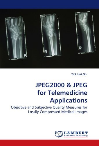 Cover for Tick Hui Oh · Jpeg2000: Objective and Subjective Quality Measures for Lossily Compressed Medical Images (Paperback Bog) (2009)