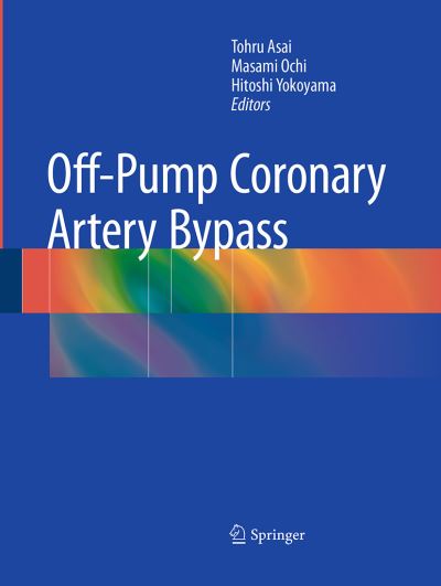Cover for Off-Pump Coronary Artery Bypass (Pocketbok) [Softcover reprint of the original 1st ed. 2016 edition] (2016)