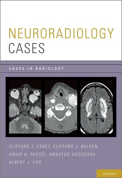 Cover for Eskey, Clifford J. (Director, Division of Neuroradiology, Director, Division of Neuroradiology, Dartmouth-Hitchcock Medical Center, Lebanon, New Hampshire) · Neuroradiology Cases - Cases in Radiology (Paperback Bog) (2012)