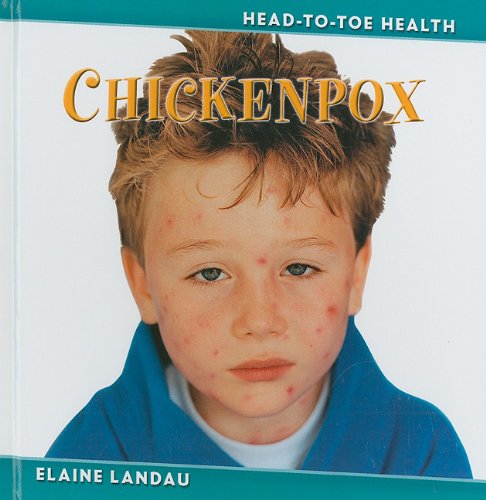 Cover for Elaine Landau · Chickenpox (Head-to-toe Health) (Hardcover Book) (2010)