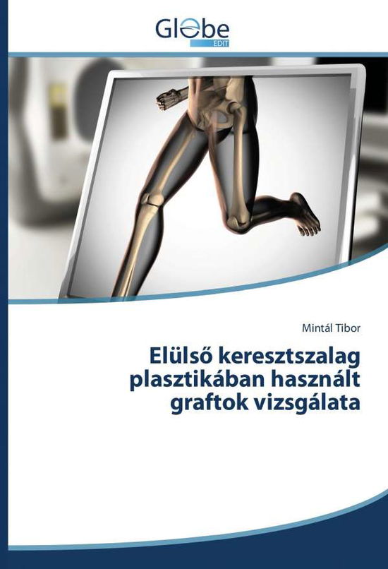 Cover for Tibor · Elülsö keresztszalag plasztikában (Book)