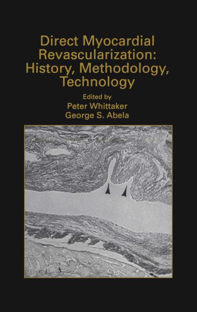 Cover for George S Abela · Direct Myocardial Revascularization: History, Methodology, Technology - Developments in Cardiovascular Medicine (Hardcover Book) [1999 edition] (1999)