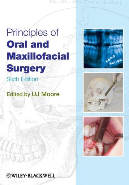 Cover for Moore, U. J. (Department of Oral Surgery, University of Newcastle-upon-Tyne, UK) · Principles of Oral and Maxillofacial Surgery (Paperback Book) (2011)