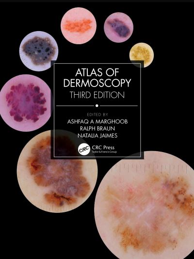 Cover for Ashfaq A Marghoob · Atlas of Dermoscopy: Third Edition (Hardcover Book) (2022)