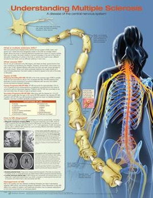 Cover for Acc · Understanding Multiple Sclerosis Anatomical Chart (Landkarten) (2019)