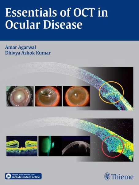 Cover for Amar Agarwal · Essentials of OCT in Ocular Disease (Hardcover Book) (2015)