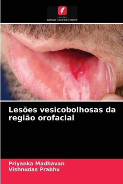 Cover for Priyanka Madhavan · Lesoes vesicobolhosas da regiao orofacial (Paperback Book) (2021)