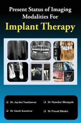 Present Status of Imaging Modalities For Implant Therapy - Dr Jayshri Nandanwar - Kirjat - Cyscoprime Publishers - 9789354461989 - torstai 3. kesäkuuta 2021