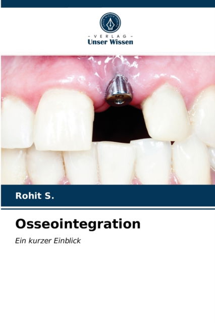Cover for Rohit S · Osseointegration (Paperback Book) (2021)