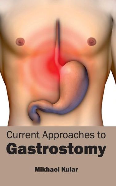 Cover for Mikhael Kular · Current Approaches to Gastrostomy (Hardcover Book) (2015)