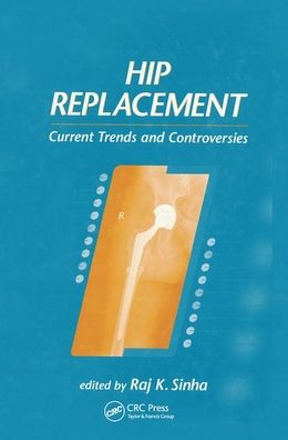 Cover for Raj K. Sinha · Hip Replacement: Current Trends and Controversies (Paperback Book) (2019)