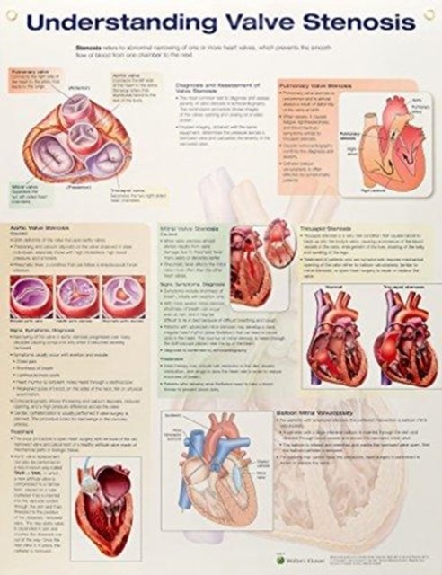 Cover for Anatomical Chart Company · Understanding Valve Stenosis (Poster) (2018)