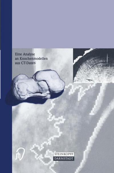 Cover for Wolfgang Zenker · Die Calcaneusfraktur : Eine Analyse an Knochenmodellen Aus Ct-daten (Paperback Book) [German edition] (1999)