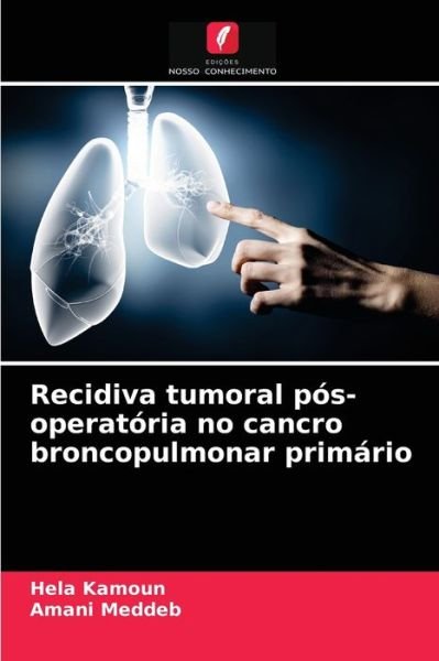 Cover for Hela Kamoun · Recidiva tumoral pos-operatoria no cancro broncopulmonar primario (Paperback Book) (2021)