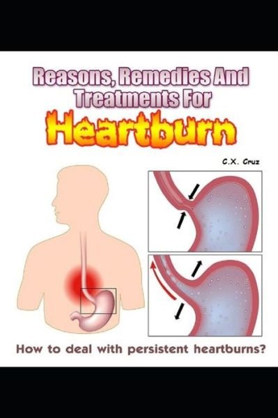 Cover for C X Cruz · Reasons, Remedies And Treatments For Heartburns: How to Deal with Persistent Heartburns? (Paperback Book) (2021)