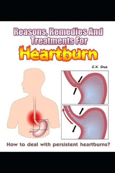 Cover for C X Cruz · Reasons, Remedies And Treatments For Heartburns: How to Deal with Persistent Heartburns? (Taschenbuch) (2021)