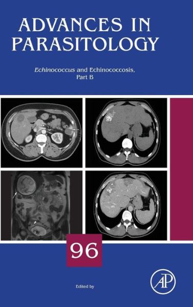 Cover for Andrew Thompson · Echinococcus and Echinococcosis, Part B (Hardcover Book) (2017)