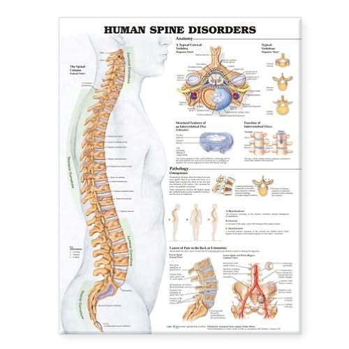 Cover for Anatomical Chart Com · Human Spine Disorders Anatomical Chart (Map) (2004)