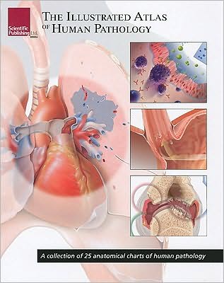 Cover for Scientific Publishing · Illustrated Atlas of Human Pathology: A Collection of 25 Anatomical Charts of Human Pathology (Pocketbok) (2009)