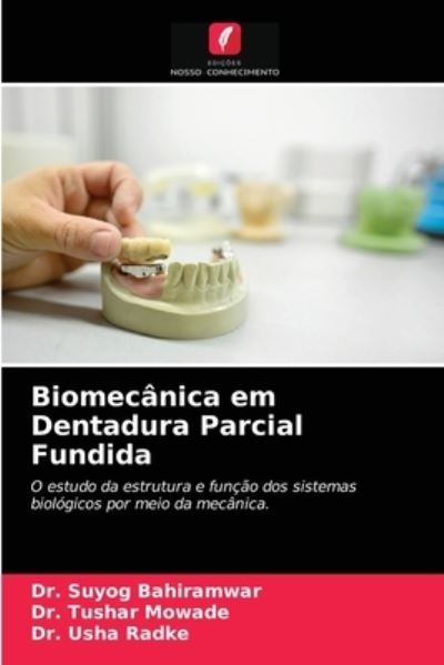 Cover for Dr Suyog Bahiramwar · Biomecanica em Dentadura Parcial Fundida (Paperback Book) (2021)